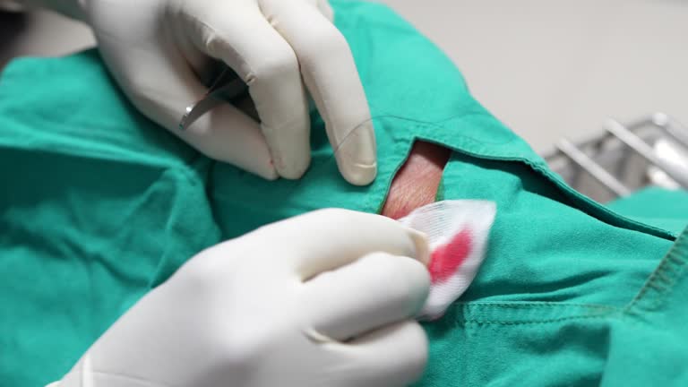 Sentio Incision Incision Healing Videos and HD Footage - Getty Images