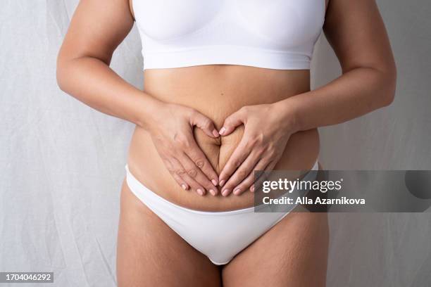 i love my body. cropped of unknown woman in underwear with body stretch marks signs posing over grey studio background. lady enjoying her natural beauty and skin imperfections - lady grey background bildbanksfoton och bilder