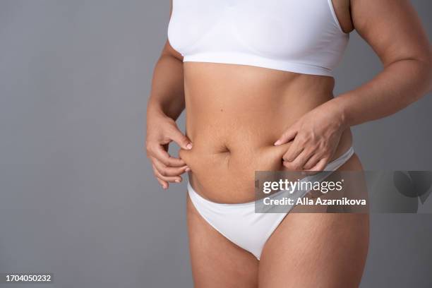 woman pulls the skin of the belly with stretch marks with hands closeup, grey background. plus size people and body positive concept - fat hips stock pictures, royalty-free photos & images