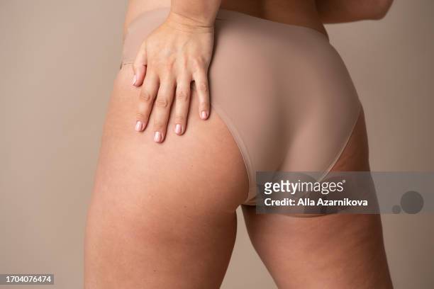 stretch marks on woman's buttocks. female after sharp weight loss shows in detail her body parts with stretch marks. close up shot of woman touching her stretch marks. skin care concept - arse stock pictures, royalty-free photos & images