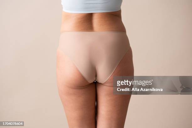 female after sharp weight loss shows in detail her buttocks with stretch marks. close up shot of woman touching her stretch marks. skin care concept - cellulit bildbanksfoton och bilder