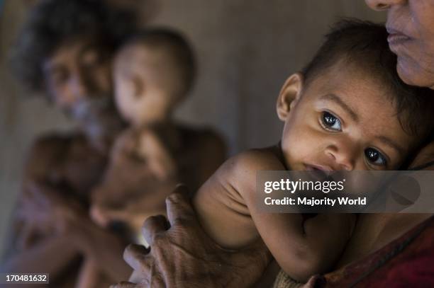 Tribal woman holds her granddaughter Rohini, suffering from grade 4 malnutrition. The seven months old twins Rohini and her brother Rohit from a...