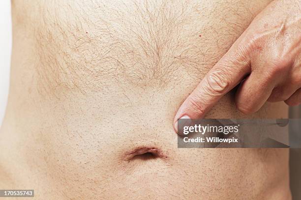 man pointing to belly button scar - hernia recovery stock pictures, royalty-free photos & images