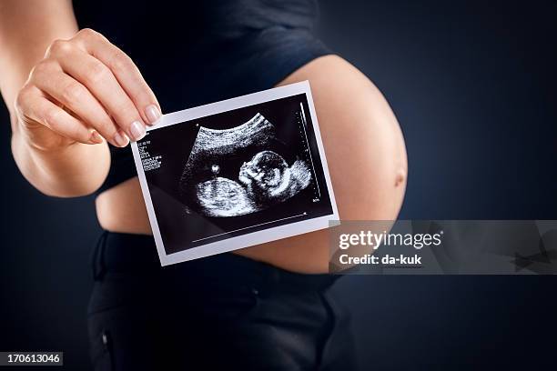 schwangere frau hält einen ultraschall bild. - fetus stock-fotos und bilder