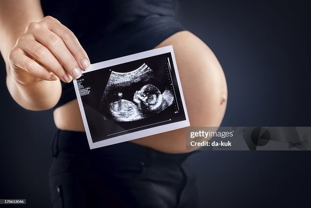 Pregnant woman holding an ultrasound image.