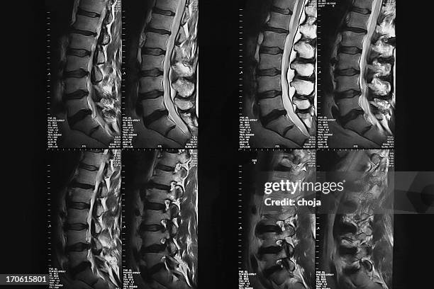 mri image of lower back...vertebral column - lower-back-x-ray stock pictures, royalty-free photos & images