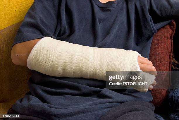 broken hand - broken arm stock pictures, royalty-free photos & images