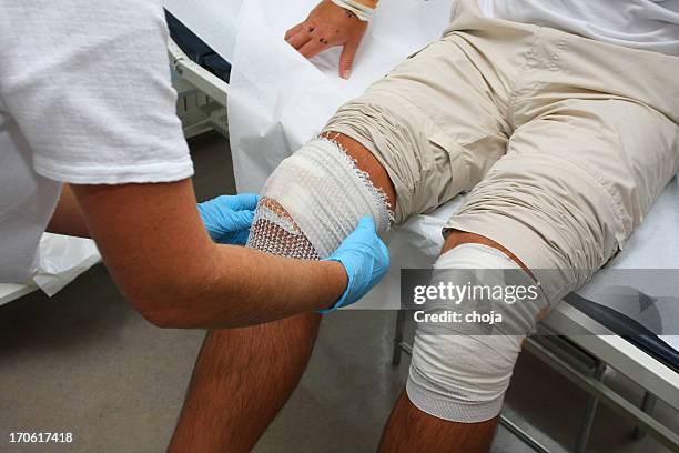 nurse is taking care of the wounded knee,changing bandage - bandage stock pictures, royalty-free photos & images