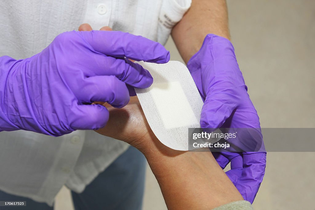 Patient après syndrome du tunnel carpien opération de chirurgie esthétique