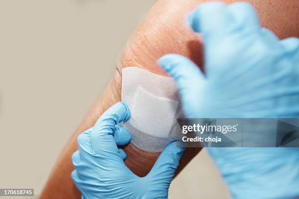 nurse is changing bandage to a wounded patient's knee - applying plaster stock pictures, royalty-free photos & images