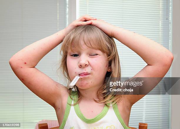 niño con termómetro varicela tener en la boca - varicela fotografías e imágenes de stock