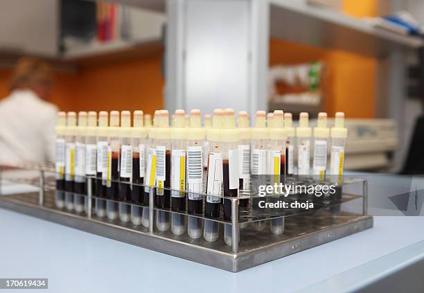 blut muster in test tubes.in blood bank - blood group stock-fotos und bilder
