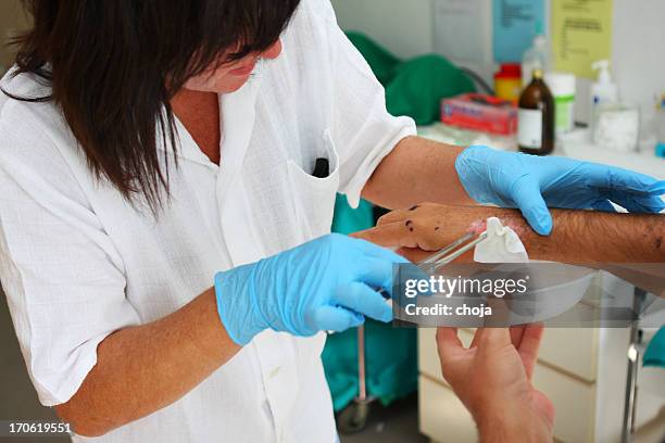 krankenschwester cleanin die wunde auf patienten's handgelenk - wunde stock-fotos und bilder