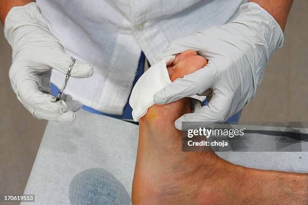 nurse is changing bandage to a wounded patient...wound on foot - bandaged thumb stock pictures, royalty-free photos & images