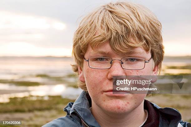 a blond male teenager with glasses and pimples - puist stockfoto's en -beelden