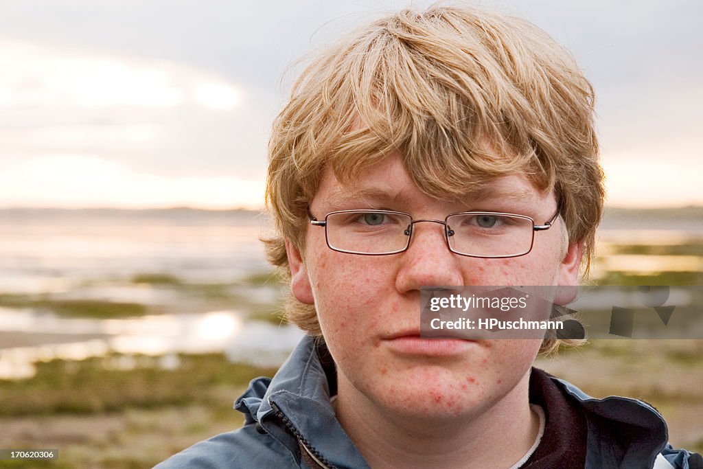 A blond male teenager with glasses and pimples