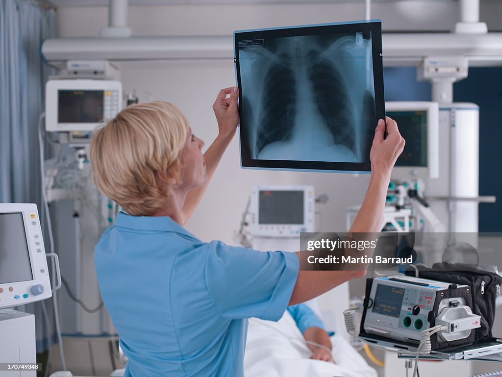 Nurse reviewing x-ray