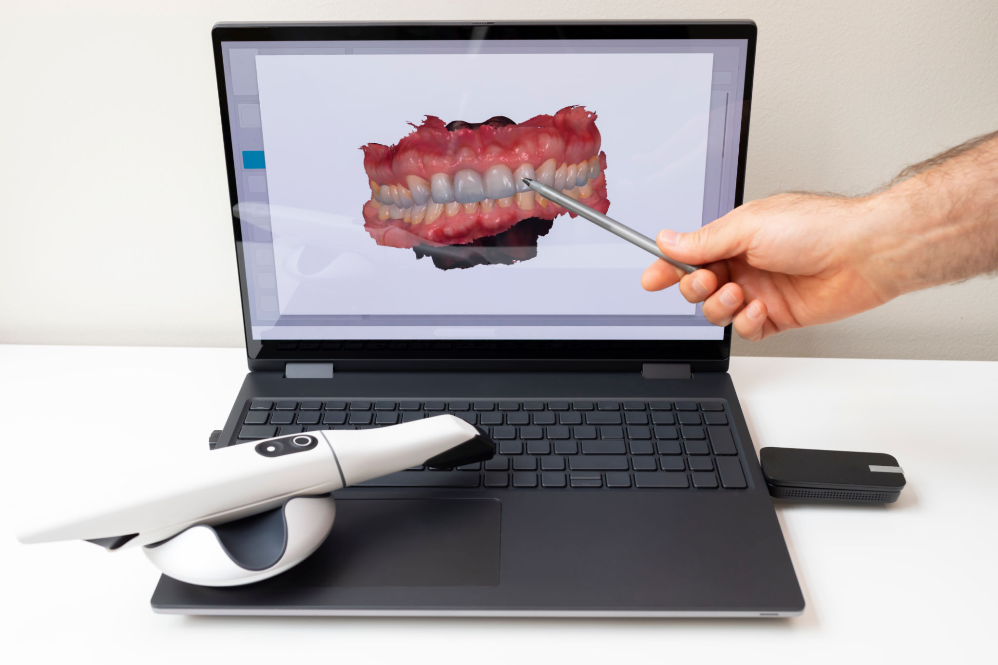 dental technology
