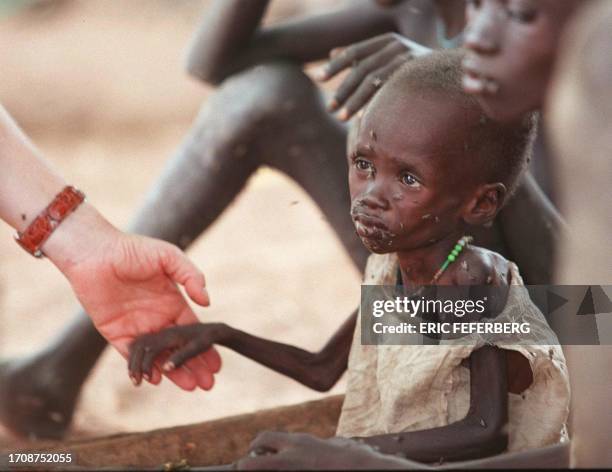 Nurse holds the hand of a malnurished child in the hospital of Wau, southern Sudan 20 July. People famine in the rebel-held areas of southern Sudan...