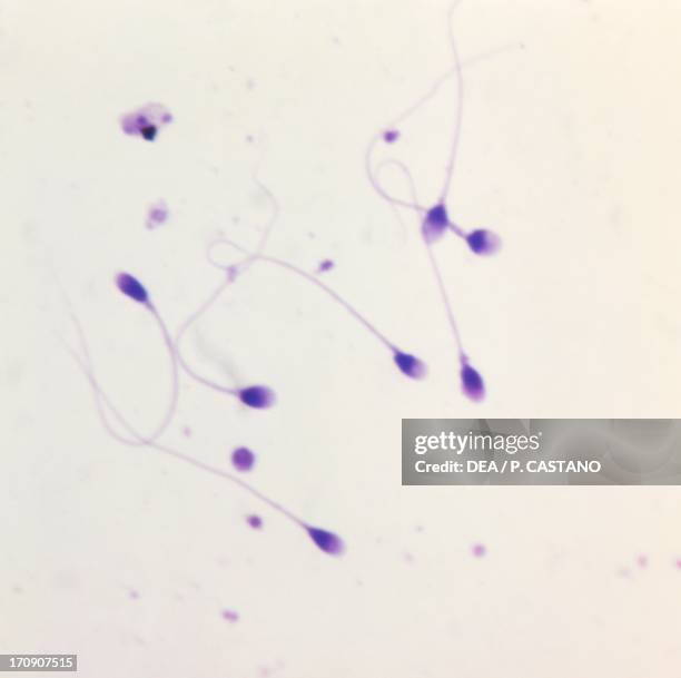 Counterstaining 35 Counterstaining Stock Photos, High-Res Pictures, and Images - Getty ...