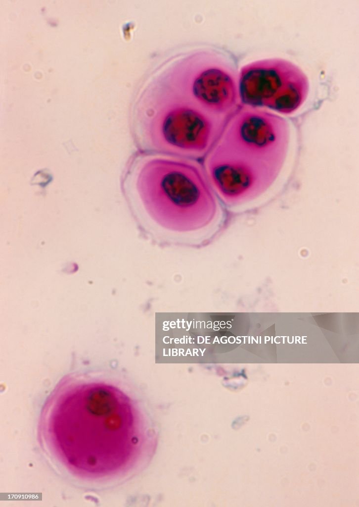 Gloeocapsa polydermatica...