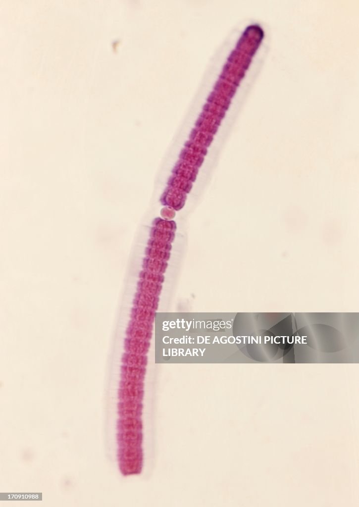 Anabaena flos-aquae...