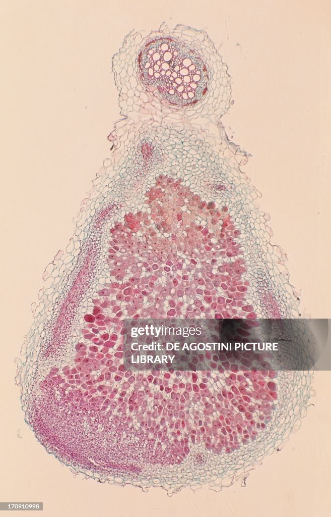Pea root tubercles