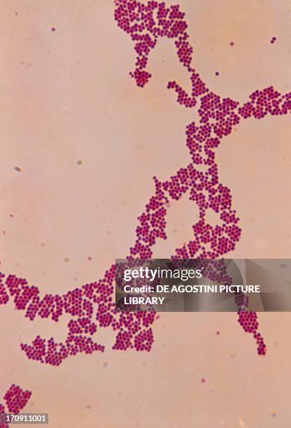 Staphylococcus Example 103 Staphylococcus Microscope Stock Photos, High-Res Pictures, and ...