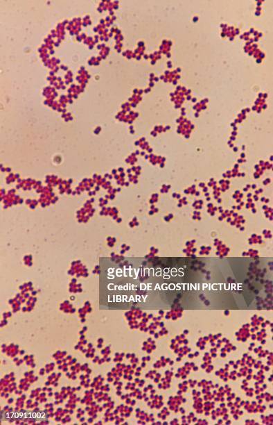 Sarcina Lutea , bacteria, grown on carrot agar, seen under a microscope.