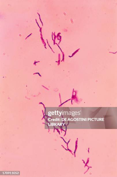 Mycobacterium leprae, also known as Hansen's coccus spirilly, bacterium that causes leprosy, seen under a microscope.