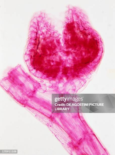 Section of tetrasporangial phase of Polysiphonia, red algae.