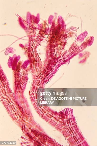 Section of the thallus with antheridia of Polysiphonia nigra, red algae, seen under a microscope.
