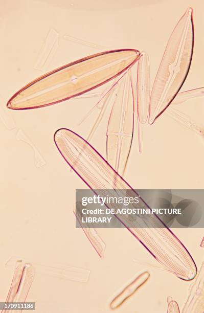 Frustules of pennate diatoms, genus Navicula and Pinnularia.