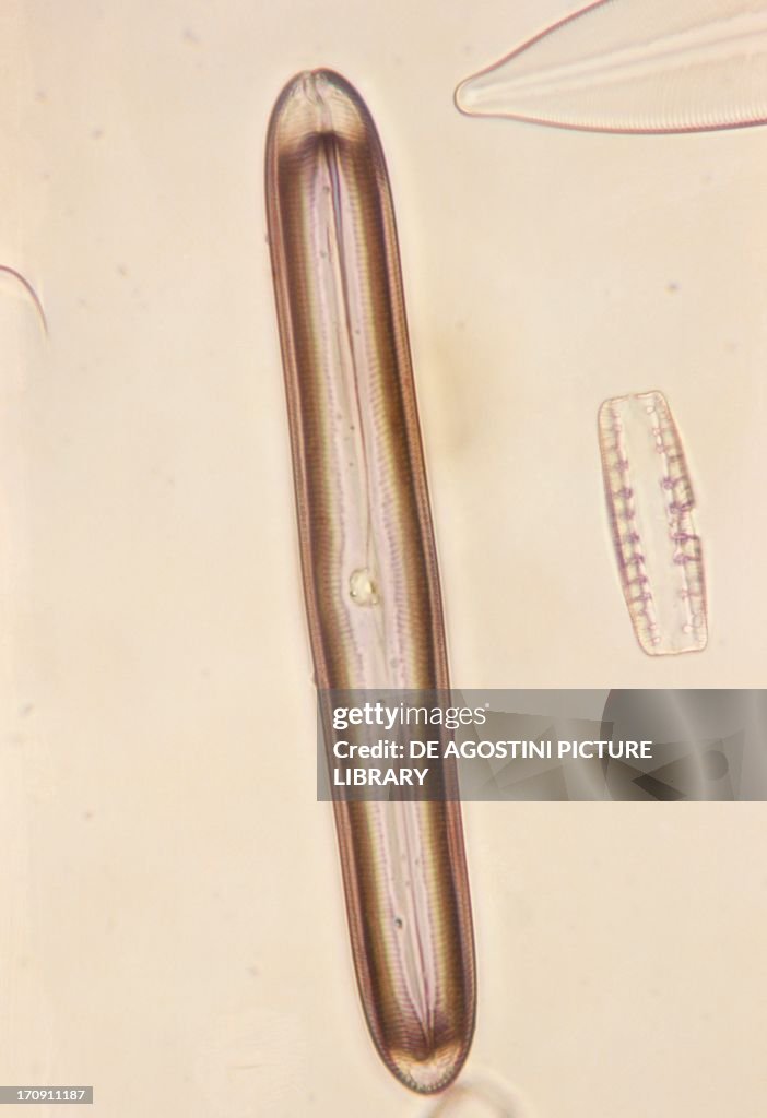 Frustules of diatom of the genus Pinnularia...