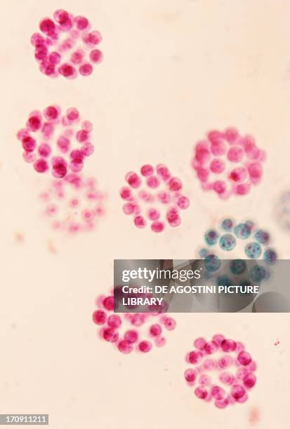 Counterstaining 35 Counterstaining Stock Photos, High-Res Pictures, and Images - Getty ...