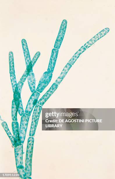 Thallus filamentous of Cladophora, genus Chlorophyceae or green algae, seen under a microscope.