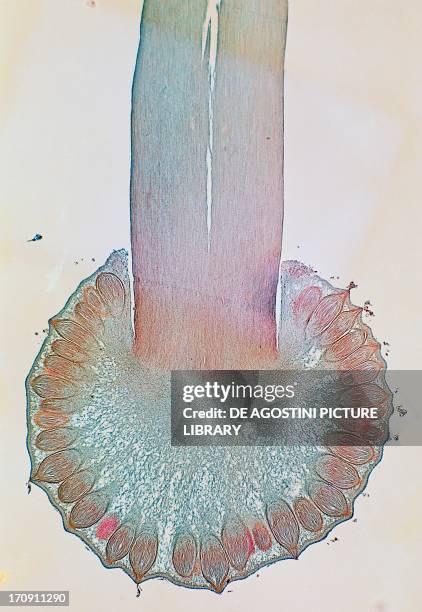Longitudinal section of spherical ergot fungus , Ascomycetes, seen under a microscope with numerous perithecia distinguishable.