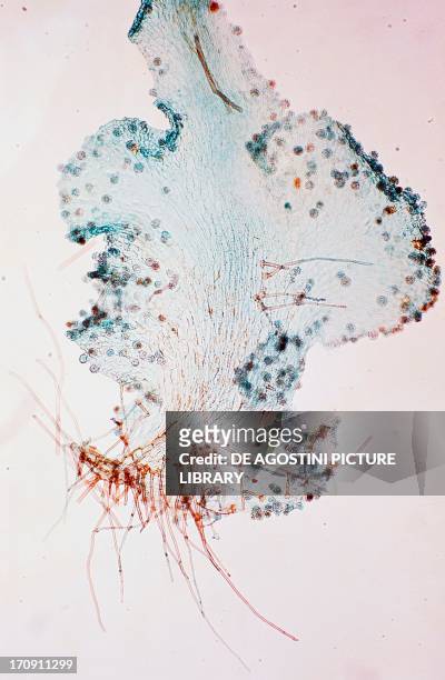 Prothallium of a fern, pteridophytes, seen under a microscope.