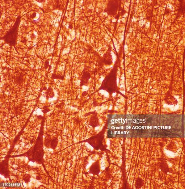 Pyramidal cells from the nervous tissue of the brain, at x190 magnification.