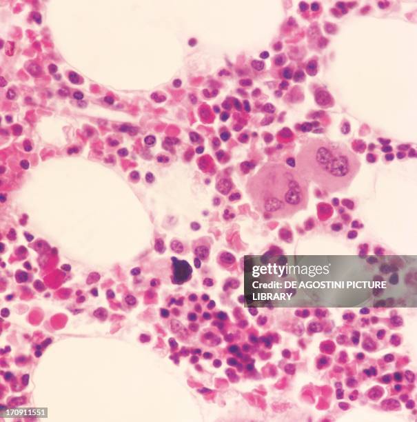 Myelocytes, human bone marrow cells, at x325 magnification.