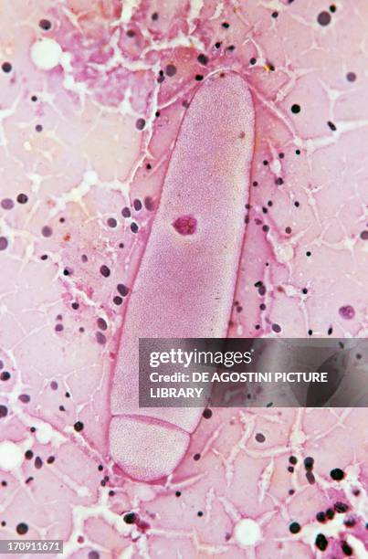 Gregarinia in the intestine of an American cockroach seen under a microscope, at x1000x1.2 magnification.