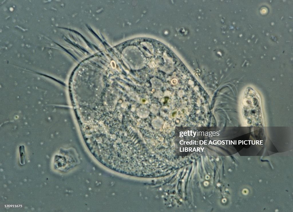 Microphotograph of ciliated Protozoan...