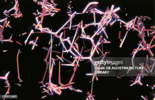 Compressed Grantia sponge spicules, Grantiidae, seen under a microscope using polarized light.