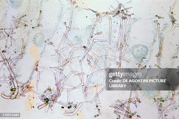 Compressed Grantia sponge spicules, Grantiidae, seen under a microscope using normal light.