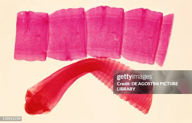 Scolex and immature proglottids of Tapeworm , Platyhelminthes flatworm, seen with counterstaining.