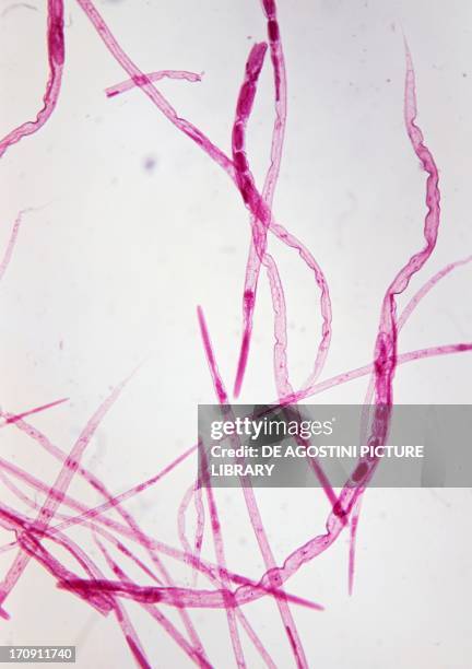 Vinegar Eel , Nematodes, seen under a microscope, at x100 magnification.