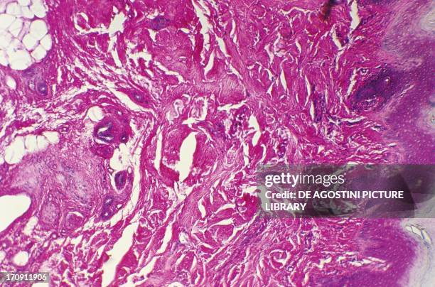 Skin Line Shape Microscope 1,818 Human Skin Under Microscope Stock Photos, High-Res Pictures, and ...