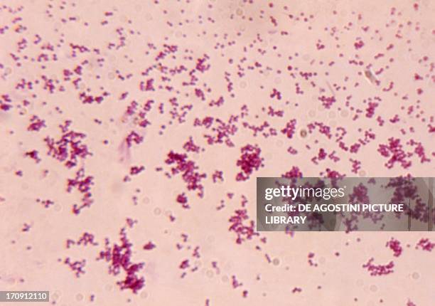Microphotograph of Staphylococcus aureus bacteria, at x1100 magnification.
