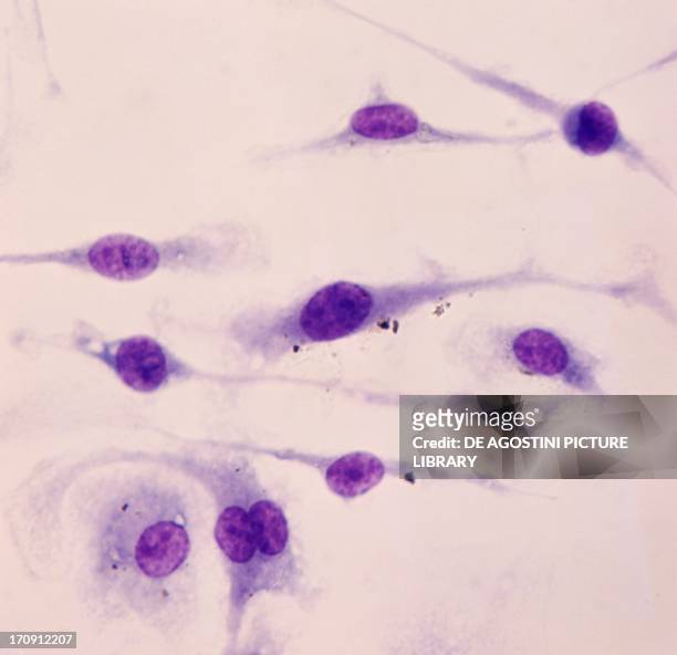 Microphotograph of in vitro culture of mouse peritoneal histiocyte, at x600 magnification.