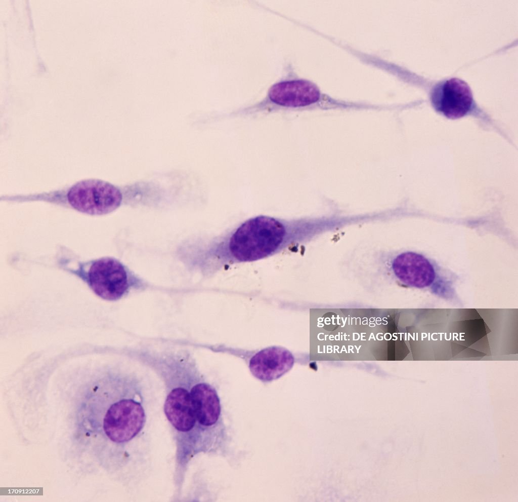 In vitro culture of mouse peritoneal histiocyte